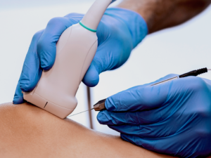 [IMAVIDA] BANNERS EXAMES - 9 PUNÇÕES